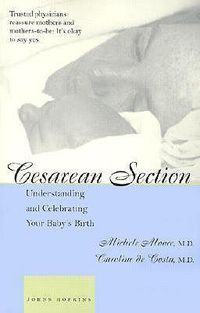 Cover image for Cesarean Section: Understanding and Celebrating Your Baby's Birth