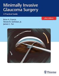 Cover image for Minimally Invasive Glaucoma Surgery: A Practical Guide