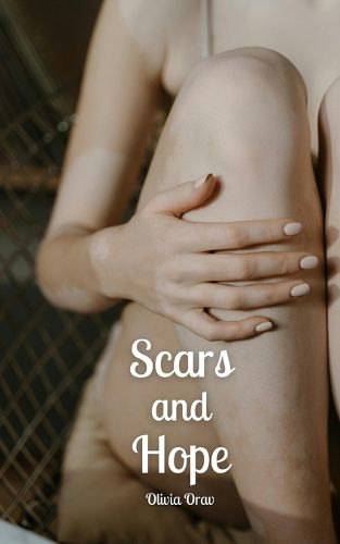 Scars and Hope