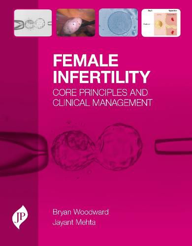 Cover image for Female Infertility: Core Principles and Clinical Management