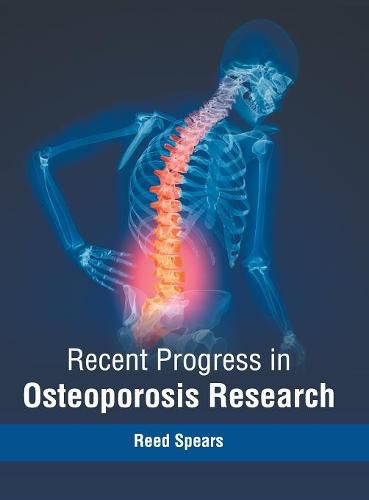 Cover image for Recent Progress in Osteoporosis Research