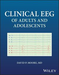 Cover image for Clinical EEG of Adults and Adolescents