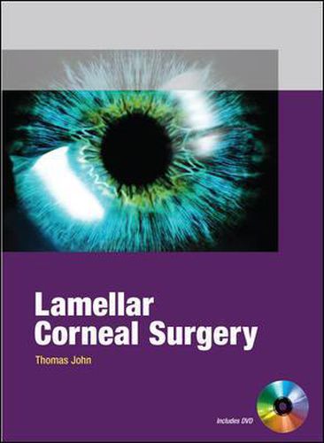 Cover image for Lamellar Corneal Surgery