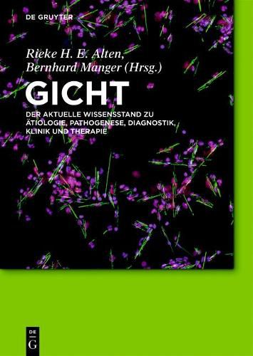 Cover image for Gicht: Der Aktuelle Wissensstand Zu AEtiologie, Pathogenese, Diagnostik, Klinik Und Therapie