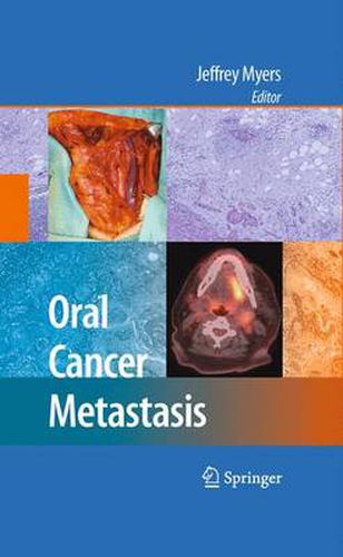 Cover image for Oral Cancer Metastasis