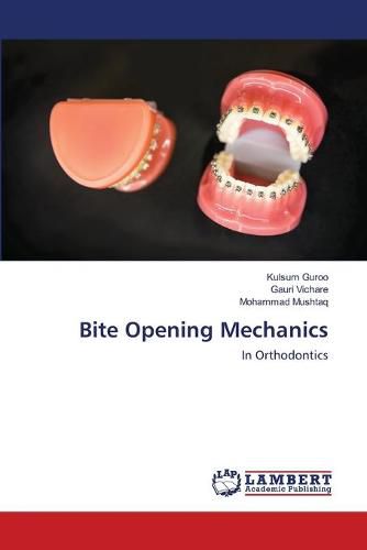 Cover image for Bite Opening Mechanics