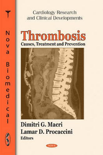 Cover image for Thrombosis: Causes, Treatment & Prevention