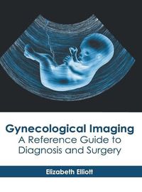 Cover image for Gynecological Imaging: A Reference Guide to Diagnosis and Surgery