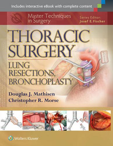 Cover image for Master Techniques in Surgery: Thoracic Surgery: Lung Resections, Bronchoplasty