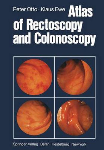 Cover image for Atlas of Rectoscopy and Coloscopy