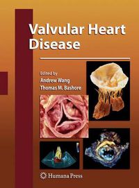 Cover image for Valvular Heart Disease