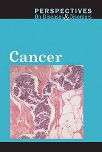 Cover image for Cancer