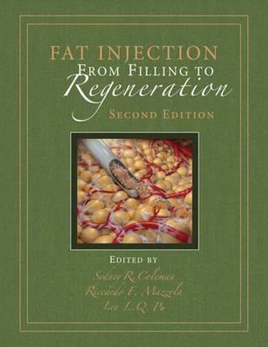 Cover image for Fat Injection: From Filling to Regeneration