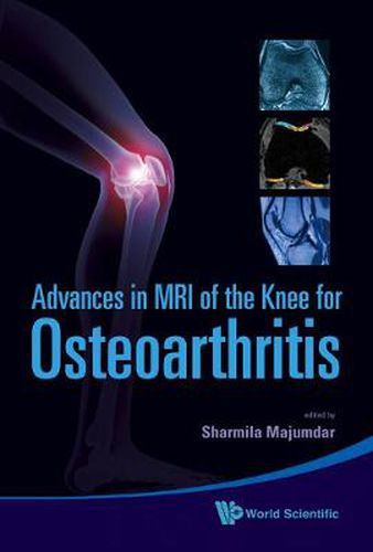 Cover image for Advances In Mri Of The Knee For Osteoarthritis