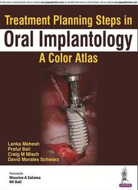 Cover image for Treatment Planning Steps in Oral Implantology: A Color Atlas