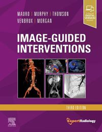 Cover image for Image-Guided Interventions: Expert Radiology Series