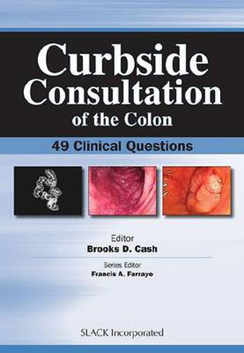 Cover image for Curbside Consultation of the Colon: 49 Clinical Questions