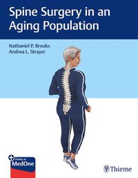 Cover image for Spine Surgery in an Aging Population