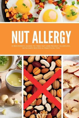 Cover image for Nut Allergy