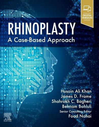 Cover image for Rhinoplasty: a Case-Based Approach