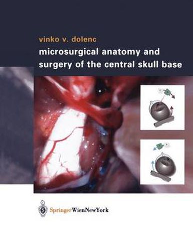 Cover image for Microsurgical Anatomy and Surgery of the Central Skull Base