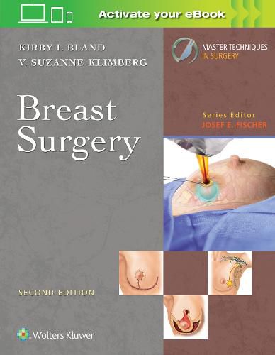 Cover image for Master Techniques in Surgery: Breast Surgery
