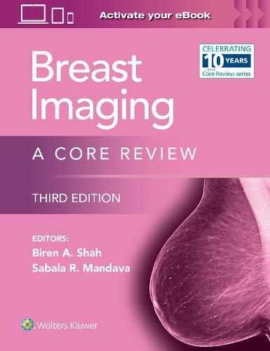 Cover image for Breast Imaging: A Core Review