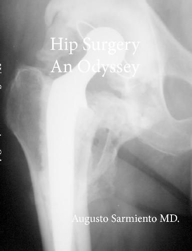 Cover image for Hip Surgery - An Odyssey