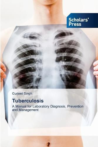 Cover image for Tuberculosis