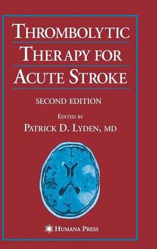 Cover image for Thrombolytic Therapy for Acute Stroke