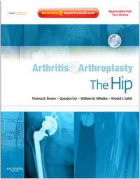 Cover image for Arthritis and Arthroplasty: The Hip: Expert Consult - Online, Print and DVD