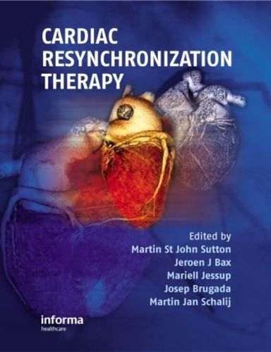 Cover image for Cardiac Resynchronization Therapy