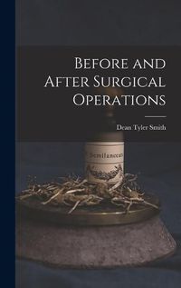 Cover image for Before and After Surgical Operations