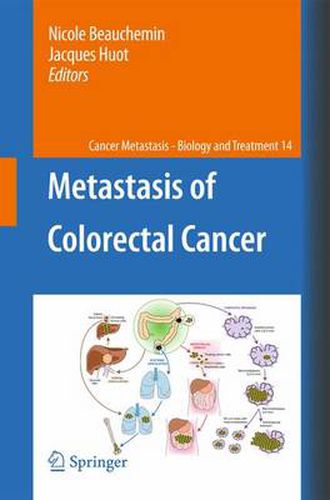 Cover image for Metastasis of Colorectal Cancer