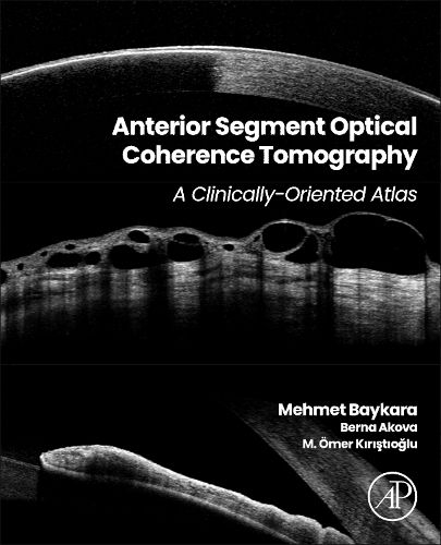 Anterior Segment Optical Coherence Tomography