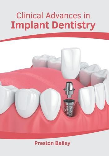 Cover image for Clinical Advances in Implant Dentistry