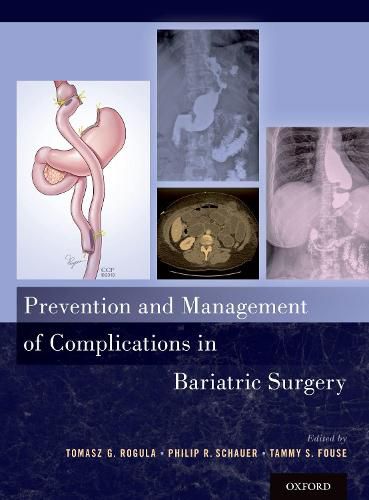 Cover image for Prevention and Management of Complications in Bariatric Surgery