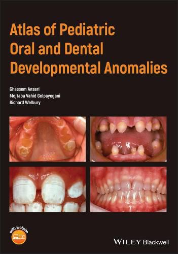 Cover image for Atlas of Pediatric Oral and Dental Developmental Anomalies