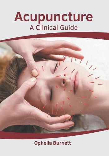 Cover image for Acupuncture: A Clinical Guide