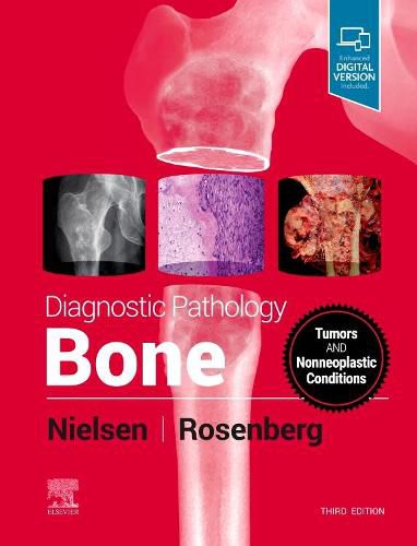 Cover image for Diagnostic Pathology: Bone