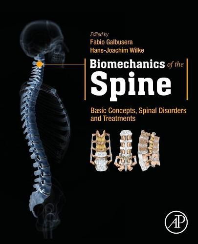 Cover image for Biomechanics of the Spine: Basic Concepts, Spinal Disorders and Treatments