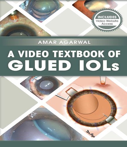 Cover image for A Video Textbook of Glued IOLs