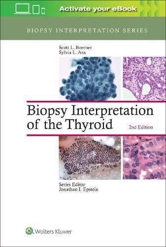 Cover image for Biopsy Interpretation of the Thyroid