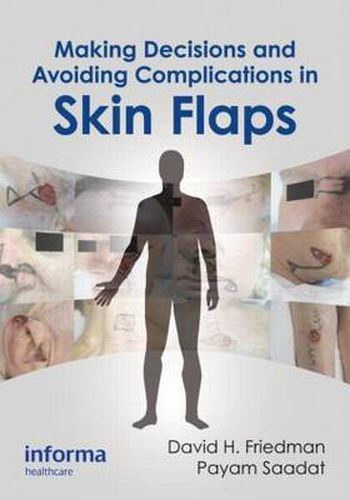 Cover image for Making Decisions and Avoiding Complications in Skin Flaps