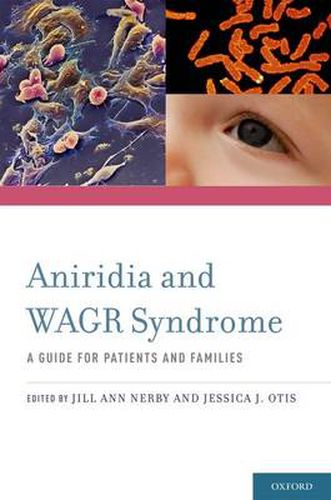 Cover image for Aniridia and WAGR Syndrome: A Guide for Patients and Their Families