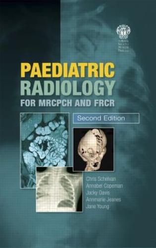 Paediatric Radiology for MRCPCH and FRCR