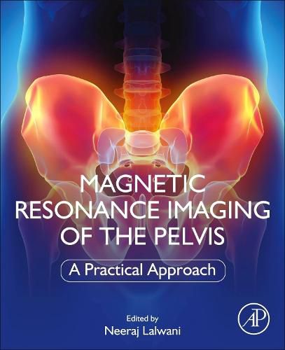 Cover image for Magnetic Resonance Imaging of The Pelvis: A Practical Approach