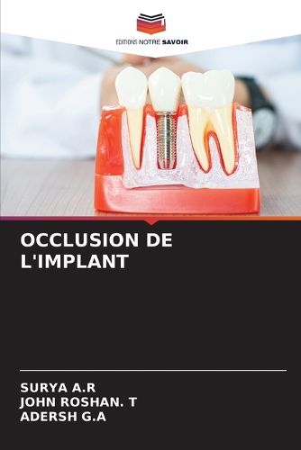Cover image for Occlusion de l'Implant