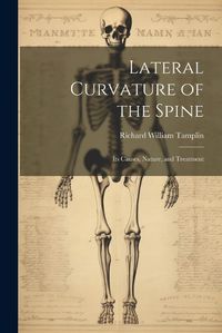 Cover image for Lateral Curvature of the Spine