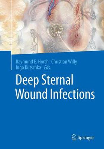 Cover image for Deep Sternal Wound Infections